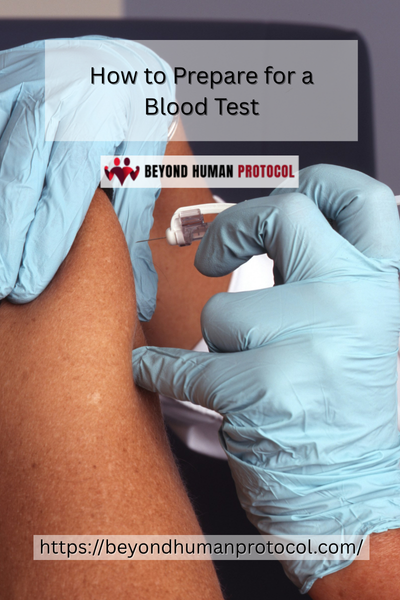 How to Prepare for a Blood Test